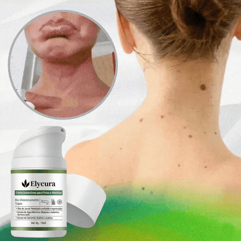 Elycura™ NatureErase: Elimine Marcas Indesejadas em 7 Dias Sem Cirurgia, Sem Dor. (Somente HOJE!)🔥